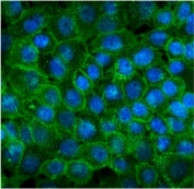 Immunofluorescent staining of FFPE human A431 cells with CDH3 antibody (green) and DAPI nuclear stain (blue). HIER: steam section in pH6 citrate buffer for 20 min.