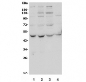 Western blot testing of human 1) HeLa, 2) HepG2, 3) PC-3 and 4) A549 lysate with ATG4A antibody. Predicted molecular weight ~45 kDa, commonly observed between 45-60 kDa.