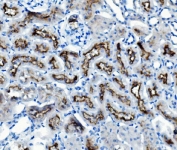 IHC staining of FFPE mouse kidney with ATG7 antibody. HIER: boil tissue sections in pH8 EDTA for 20 min and allow to cool before testing.
