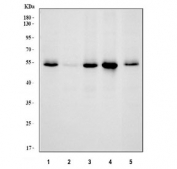 Western blot testing of 1) human HeLa, 2) human HepG2, 3) human 293T, 4) monkey COS-7 and 5) human Caco-2 cell lysate with SMAD5 antibody. Expected molecular weight: 52~60 kDa.