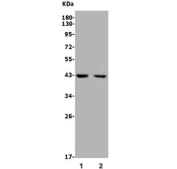 IHC staining of FFPE human breast cancer with ALKBH1 antibody. HIER: boil tissue sections in pH8 EDTA for 20 min and allow to cool before testing.