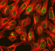 Immunofluorescent staining of FFPE human U-2 OS cells with ALKBH1 antibody (green) and Alpha Tubulin mAb (red). HIER: steam section in pH6 citrate buffer for 20 min.