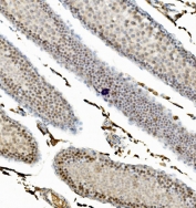 IHC staining of FFPE rat testis with CCNB1 antibody. HIER: boil tissue sections in pH8 EDTA for 20 min and allow to cool before testing.