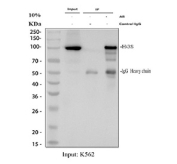 Immunoprecipitation of HGS protein from 500ug of human K562 whole cell lysate with 2ug of HGS antibody.