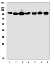 Western blot testing of human 1) HeLa, 2) HEK293, 3) K562, 4) SK-O-V3, 5) PC-3, 6) A549 and 7) HepG2 cell lysate with HGS antibody. Predicted molecular weight ~86 kDa, commonly observed at 110-115 kDa.
