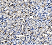 IHC staining of FFPE rat kidney with MCM5 antibody. HIER: boil tissue sections in pH8 EDTA for 20 min and allow to cool before testing.