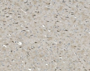 IHC staining of FFPE rat brain with ULK1 antibody. HIER: boil tissue sections in pH8 EDTA for 20 min and allow to cool before testing.