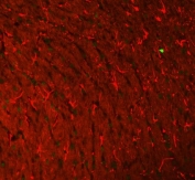 Immunofluorescent staining of FFPE rat brain tissue with GFAP antibody (red) and DAPI nuclear stain (blue). HIER: boil tissue sections in pH8 EDTA for 20 min and allow to cool before testing.
