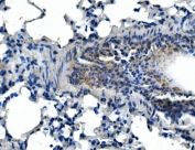 IHC staining of FFPE mouse lung tissue with Adam28 antibody. HIER: boil tissue sections in pH8 EDTA for 20 min and allow to cool before testing.
