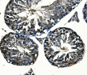 IHC staining of FFPE rat gastric tissue with Adam28 antibody. HIER: boil tissue sections in pH8 EDTA for 20 min and allow to cool before testing.
