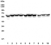 Western blot testing of human 1) placenta, 2) PC-3, 3) A549, 4) U-2 OS and rat 5) brain, 6) liver, 7) ovary and mouse 8) brain, 9) liver and 10) ovary lysate with ASIC2 antibody. Predicted molecular weight ~58 kDa.
