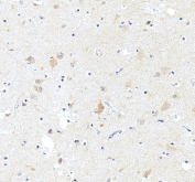 IHC staining of FFPE human brain tissue with ASIC2 antibody, HRP-secondary and DAB substrate. HIER: boil tissue sections in pH8 EDTA for 20 min and allow to cool before testing.