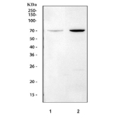 Western blot testing of 1) rat brain and 2) mouse brain tissue lysate with Chat antibody. Predicted molecular weight ~83/74/70 kDa (isoforms M/S/R).
