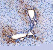 IHC staining of FFPE rat liver tissue with Cd31 antibody, HRP-secondary and DAB substrate. HIER: boil tissue sections in pH8 EDTA for 20 min and allow to cool before testing.