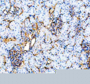IHC staining of FFPE rat kidney tissue with Cd31 antibody, HRP-secondary and DAB substrate. HIER: boil tissue sections in pH8 EDTA for 20 min and allow to cool before testing.