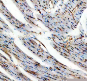 IHC staining of FFPE rat heart tissue with Cd31 antibody, HRP-secondary and DAB substrate. HIER: boil tissue sections in pH8 EDTA for 20 min and allow to cool before testing.