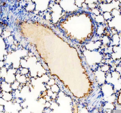 IHC staining of FFPE rat lung tissue with Cd31 antibody, HRP-secondary and DAB substrate. HIER: boil tissue sections in pH8 EDTA for 20 min and allow to cool before testing.