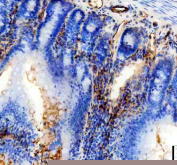 IHC staining of FFPE rat colon tissue with Cd31 antibody, HRP-secondary and DAB substrate. HIER: boil tissue sections in pH8 EDTA for 20 min and allow to cool before testing.