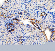 IHC staining of FFPE mouse kidney tissue with Cd31 antibody, HRP-secondary and DAB substrate. HIER: boil tissue sections in pH8 EDTA for 20 min and allow to cool before testing.