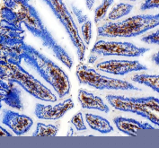 IHC staining of FFPE mouse colon tissue with Cd31 antibody, HRP-secondary and DAB substrate. HIER: boil tissue sections in pH8 EDTA for 20 min and allow to cool before testing.
