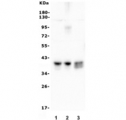 Western blot testing of human 1) HepG2, 2) HeLa and 3) SW620 lysate with ATF1 antibody. Routinely observed molecular weight: 29-35 kDa.