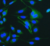 Immunofluorescent staining of FFPE human HeLa cells with Keratin 18 antibody (green) and DAPI nuclear stain (blue). HIER: steam section in pH6 citrate buffer for 20 min.