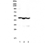 Western blot testing of human 1) placenta, 2) Caco-2 and 3) A549 lysate with Keratin 18 antibody. Predicted molecular weight ~48 kDa.