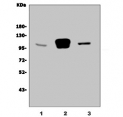 Western blot testing of 1) human HL60, 2) rat brain and 2) mouse brain lysate with GRID2 antibody. Predicted molecular weight ~113 kDa.