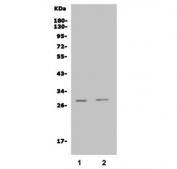 Western blot testing of rat 1) liver and 2) lung lysate with Insig1 antibody. Predicted molecular weight ~30 kDa with a 66-70 kDa precursor.