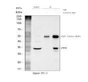 Immunoprecipitation of Cyclophilin E protein from 500ug of human PC-3 whole cell lysate with 2ug of Cyclophilin E antibody.
