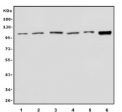 Western blot testing of 1) human HeLa, 2) human placenta, 3) monkey kidney, 4) rat kidney, 5) rat lung and 6) mouse kidney lysate with RAPGEF3 antibody. Predicted molecular weight ~104 kDa. 
