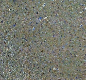 IHC staining of FFPE rat brain tissue with DNAJC6 antibody. HIER: boil tissue sections in pH8 EDTA for 20 min and allow to cool before testing.