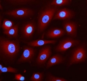 Immunofluorescent staining of FFPE human A549 cells with DNAJC6 antibody (red) and DAPI nuclear stain (blue). HIER: steam section in pH6 citrate buffer for 20 min.