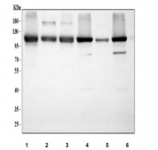 Western blot testing of 1) human HEL, 2) human K562, 3) human SH-SY5Y, 4) rat brain, 5) rat PC-12 and 6) mouse brain tissue lysate with DNAJC6 antibody. Predicted molecular weight ~120 kDa.