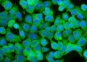Immunofluorescent staining of FFPE human Caco-2 cells with GCHFR antibody (green) and DAPI nuclear stain (blue). HIER: steam section in pH6 citrate buffer for 20 min.