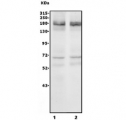 Western blot testing of 1) rat brain and 2) mouse brain lysate with NRXN3 antibody. Predicted molecular weight ~185 kDa.