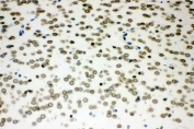 IHC staining of FFPE rat brain with SUMO1 antibody. HIER: boil tissue sections in pH8 EDTA for 20 min and allow to cool before testing.