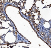 IHC staining of FFPE mouse lung with CES1 antibody. HIER: boil tissue sections in pH8 EDTA for 20 min and allow to cool before testing.