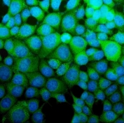 Immunofluorescent staining of FFPE human MCF7 cells with Argininosuccinate Synthetase 1 antibody (green) and DAPI nuclear stain (blue). HIER: steam section in pH6 citrate buffer for 20 min.