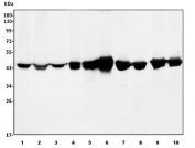 Western blot testing of 1) human HeLa, 2) human HepG2, 3) human HEK293, 4) human ThP-1, 5) human T-47D, 6) monkey kidney, 7) rat liver, 8) rat kidney, 9) mouse liver and 10) mouse kidney lysate with ASS1 antibody. Predicted molecular weight ~46 kDa.
