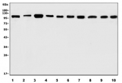 Western blot testing of 1) human Hela, 2) human SH-SY5Y, 3) human A431, 4) human U-87 MG, 5) rat brain, 6) rat lung, 7) rat stomach, 8) mouse brain, 9) mouse lung and 10) mouse stomach lysate with AFAP1 antibody. Predicted molecular weight ~120 kDa.