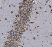 IHC staining of FFPE mouse brain with KCNQ5 antibody. HIER: boil tissue sections in pH8 EDTA for 20 min and allow to cool before testing.