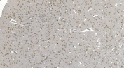 IHC staining of FFPE rat brain with DDX1 antibody. HIER: boil tissue sections in pH8 EDTA for 20 min and allow to cool before testing.