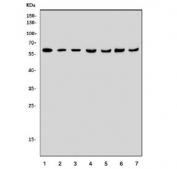 Western blot testing of 1) rat brain, 2) mouse brain, 3) mouse Neuro-2a, 4) human HEK293, 5) human Jurkat, 6) human PC-3 and 7) human HeLa cell lysate with BCL3 antibody. Predicted molecular weight ~60 kDa.