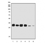 Western blot testing of 1) rat liver, 2) rat kidney, 3) rat testis, 4) mouse liver, 5) mouse kidney and 6) mouse testis tissue lysate with SRD5A1 antibody. Predicted molecular weight ~29 kDa.