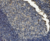 IHC staining of FFPE human tonsil tissue with Clathrin heavy chain antibody. HIER: boil tissue sections in pH8 EDTA for 20 min and allow to cool before testing.