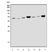 Western blot testing of 1) human HL60, 2) human ThP-1, 3) rat brain, 4) rat heart, 5) mouse brain, 6) mouse kidney and 7) mouse heart tissue lysate with ACVRL1 antibody. Predicted molecular weight ~56 kDa.
