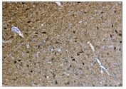 IHC staining of FFPE mouse brain tissue with CAMKIV antibody. HIER: boil tissue sections in pH8 EDTA for 20 min and allow to cool before testing.