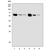 Western blot testing of 1) rat brain, 2) rat thymus, 3) rat testis, 3) mouse brain, 4) rat thymus and 6) rat testis tissue lysate with CAMKIV antibody. Predicted molecular weight ~58 kDa.