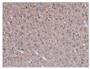 IHC staining of FFPE rat brain tissue with PGP9.5 antibody. HIER: boil tissue sections in pH8 EDTA for 20 min and allow to cool before testing.